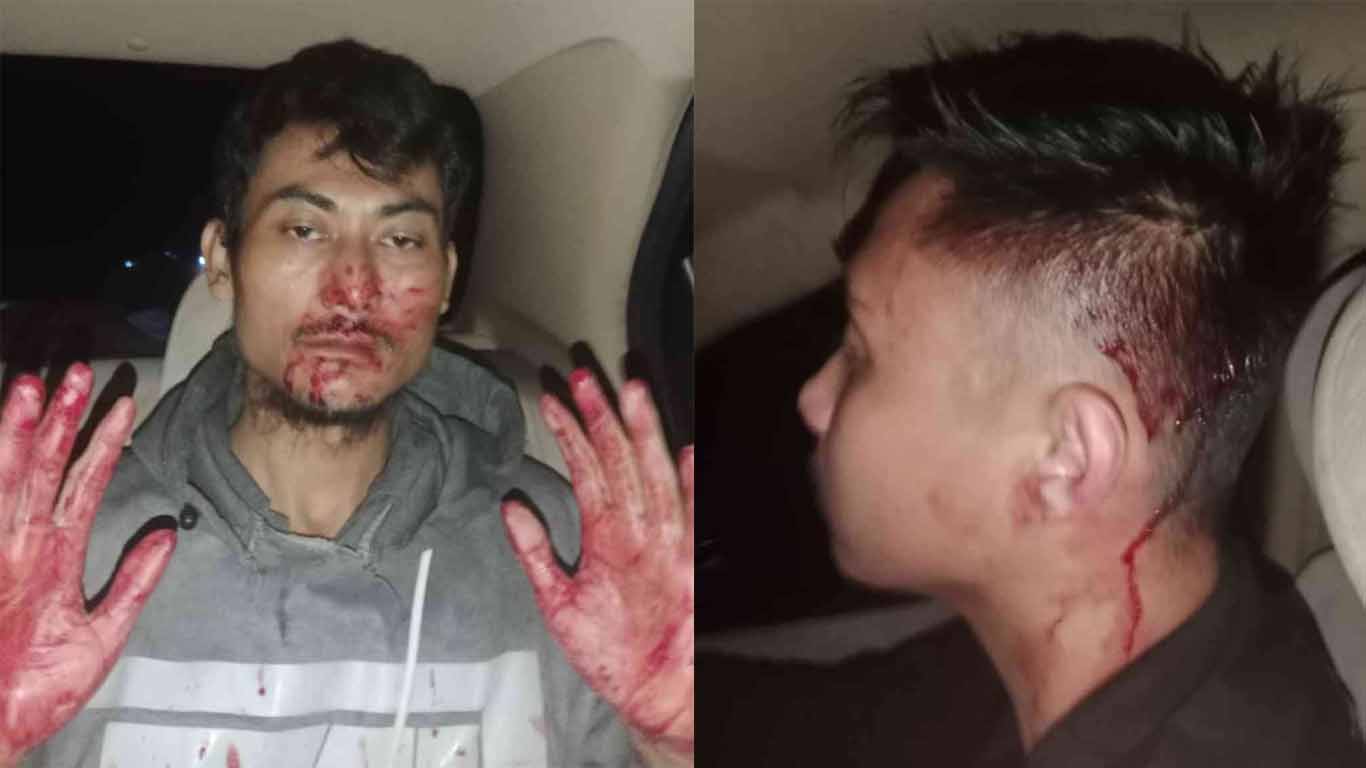 Oknum Ormas Keroyok 2 Jurnalis FWJI di Kuningan